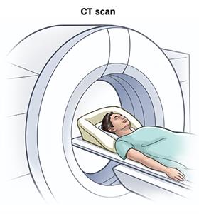 CT Scan image